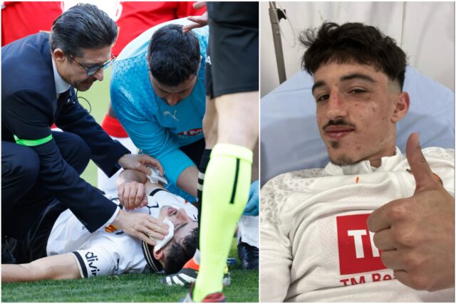 Diego López será operado após sofrer fratura na bochecha esquerda