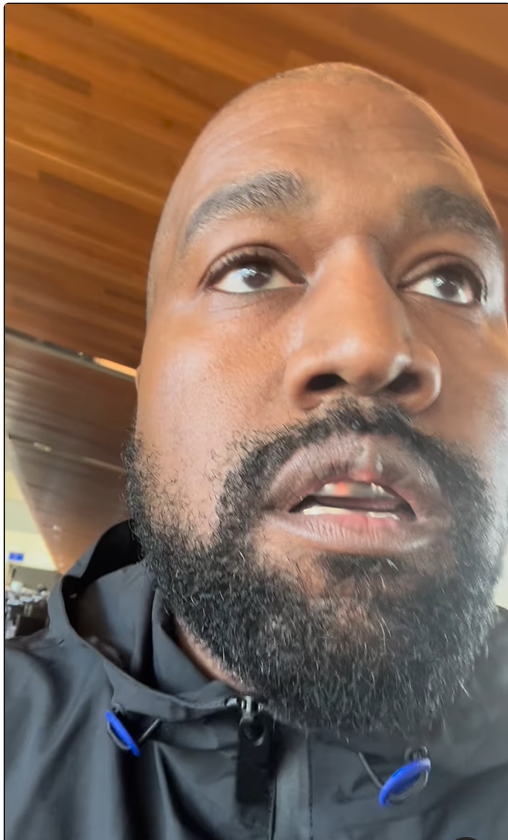 Fãs de Kanye West alarmados com ‘crescimento’ em seu lábio superior após obter dentes de titânio