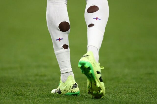Buracos nas meias de Bukayo Saka durante um jogo de preparação para a Euro 2024 da Inglaterra