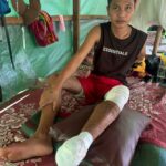 Aung Nge sentada numa almofada no chão de um abrigo.  Ele tem grandes bandagens ao redor do pé e joelho esquerdos.