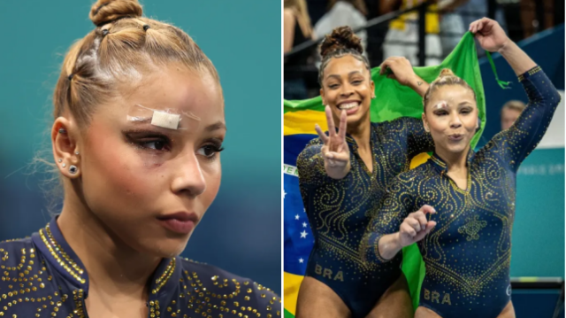 A ginasta brasileira Flávia Saraiva sofreu um corte feio acima do olho após cair no aquecimento
