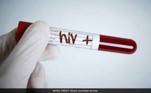 Pacientes com HIV curados através de transplantes arriscados são agora “prova viva” de esperança