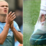 Erling Haaland foi visto com sangue nas meias durante o empate de 1 a 1 do Man City contra o Newcastle