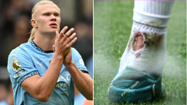 Erling Haaland foi visto com sangue nas meias durante o empate de 1 a 1 do Man City contra o Newcastle